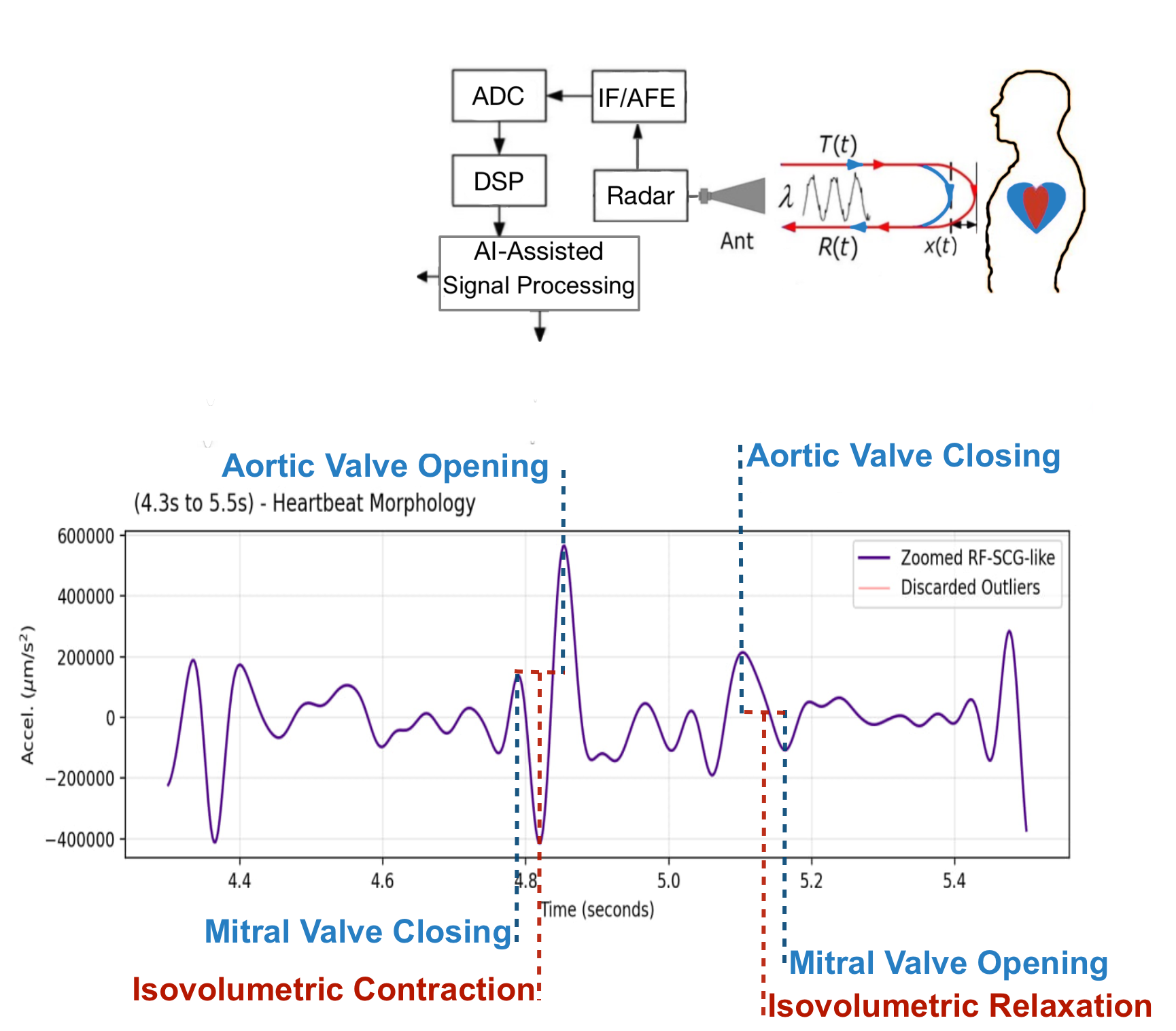 RFCARDIA RF signal processing and SCG-like reconstruction visual