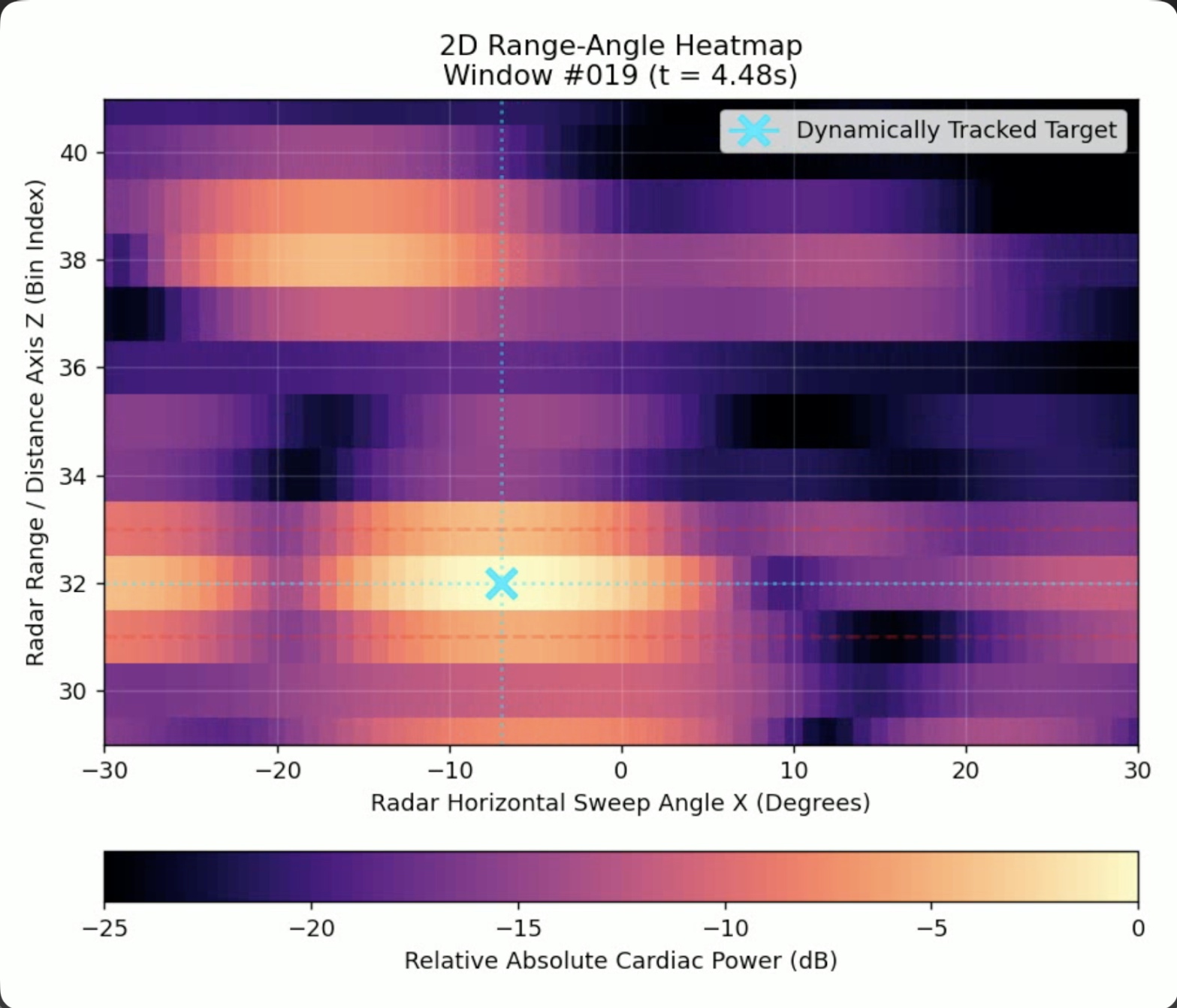 Static frame of AI-assisted heart localization